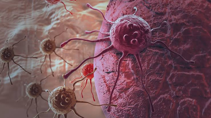 Casos de câncer em adultos jovens disparam 284% no SUS nos últimos&nbsp;anos