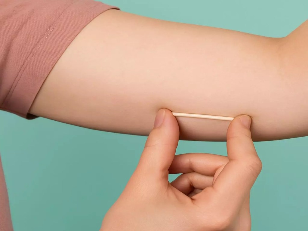 Cuiabá passa a oferecer chip anticoncepcional pelo SUS nas unidades de&nbsp;saúde